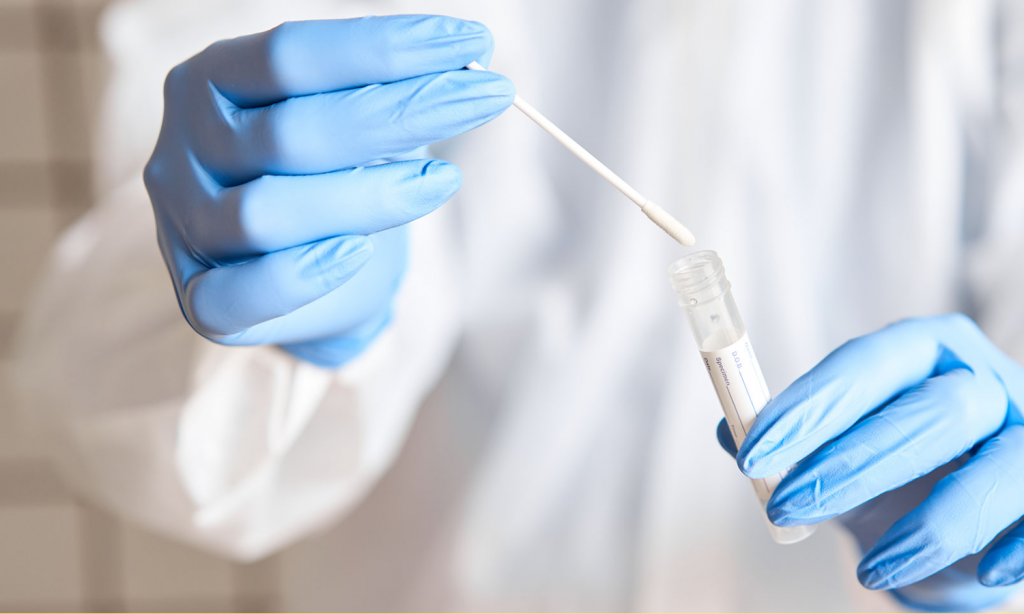 fiocruz desenvolve teste único para covid 19 e gripe abc